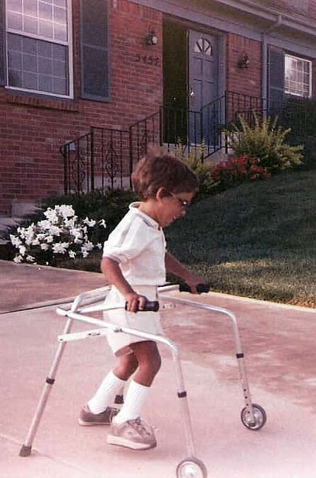 Adam using walker after first Adam's Camp, summer of 1986